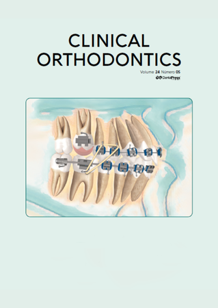 Protocolo de aumento da altura facial anterior inferior em pacientes adultos não cirúrgicos. Uma abordagem biomecânica conservadora, com rotação horária da mandíbula: relato de caso