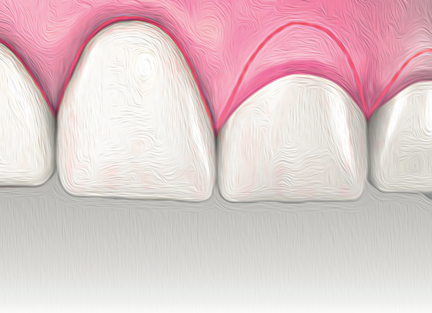 Cirurgia plástica periodontal: determinantes de sucesso relativos ao paciente — revisão narrativa