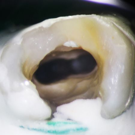 Endodontics 2023 v13n1