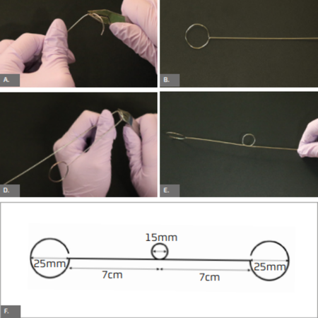 An in-house device to improve isolation for posterior teeth bonding