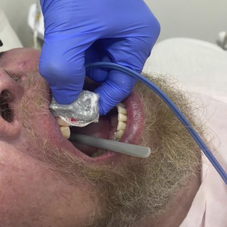 Oxigenação pulpar avaliada pela oximetria de pulso em pacientes submetidos à radioterapia para tratamento do câncer bucal