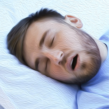 Sleep apnea: the essentials every clinical dentist needs to know