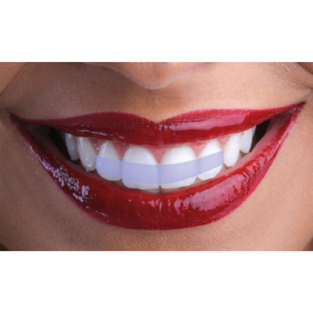 Interdental papillae and smile aesthetics: an orthodontic and periodontal approach