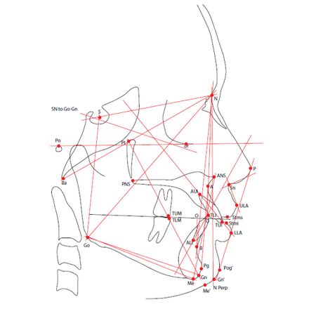 Reproducibility of linear and angular cephalometric measurements obtained by an artificial-intelligence assisted software (WebCeph) in comparison with digital software (AutoCEPH) and manual tracing method
