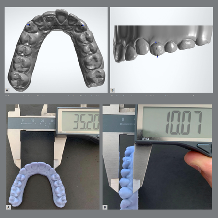 Evaluation of the agreement of horizontal and vertical linear measurements obtained from digital models, printed models and direct measurements