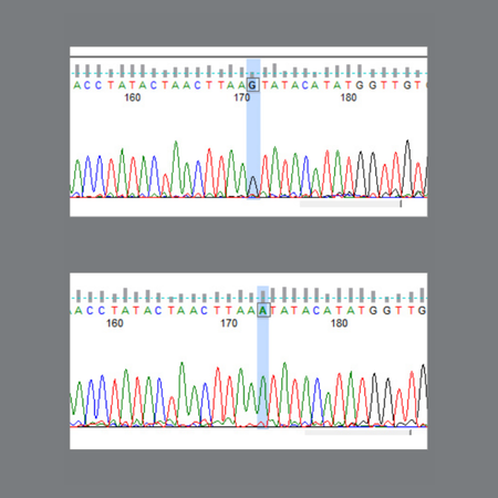 Genetic association between Class II division 1 and division 2 malocclusions with PAX9 (rs8004560) gene polymorphism in a tertiary care hospital