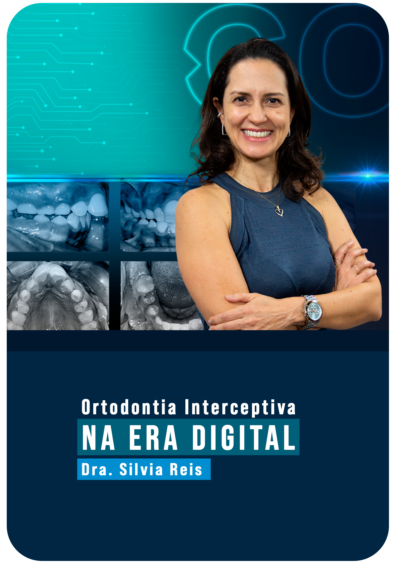 Ortodontia Interceptiva na Era Digital - ampliando possibilidades  Profa. Silvia Reis