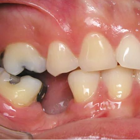 Orthodontic mechanics and smile aesthetics: a powerful combination in Orthodontics