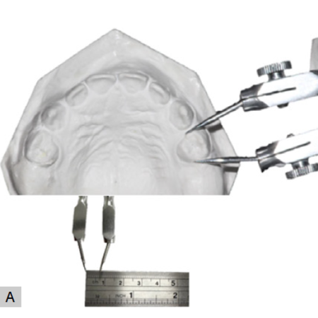 Comparação de três instrumentos (analógico, analógico com visor digital e digital) para medições dentárias lineares em modelos de gesso e modelos digitalizados de bebês e crianças: um estudo de concordância e reprodutibilidade