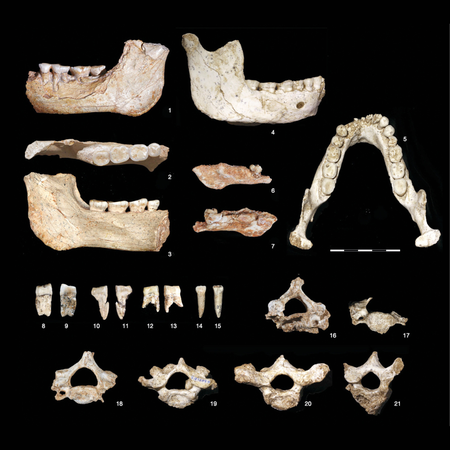 The oldest fossils and partial anodontia: reflections