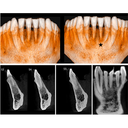 Periapical cemento-osseous dysplasia: contraindication for orthodontic and endodontic treatment