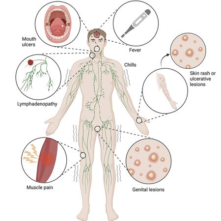 Prática clínica endodôntica e o vírus Monkeypox