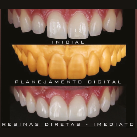 Odontologia Digital tecnologia aliada no dia a dia clínico