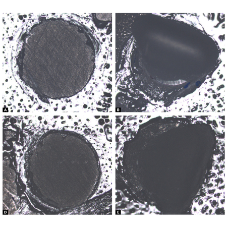 Surface Treatment for Adhesive Cementation of Printed Resin Composite Restorations