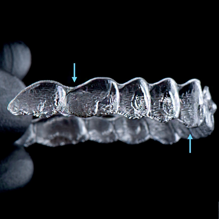 Force systems and the function of attachments in aligner biomechanics: an analytical approach