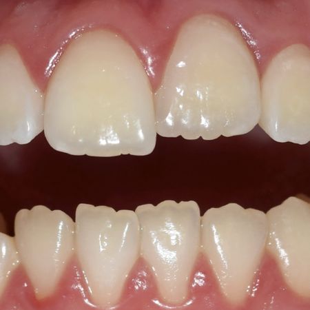 Endodontics 2023 v13n1