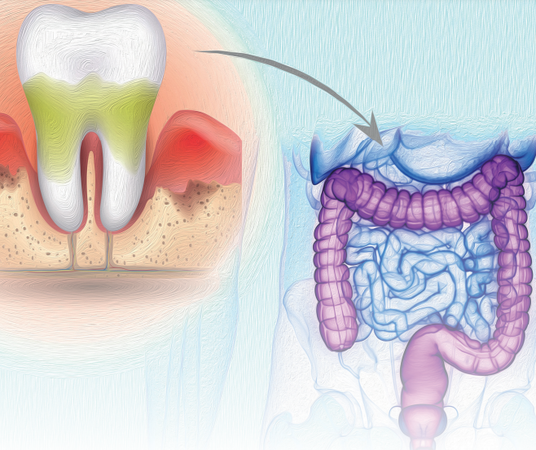 Periodontology 2022 v32n3