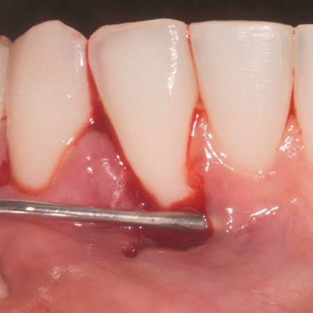 Periodontology 2025 v35n1