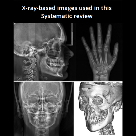 Decisões clínicas em Ortodontia utilizando imagens radiográficas e abordagens de inteligência artificial: uma revisão de escopo